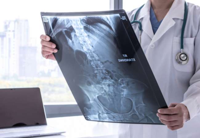 abdomen Radiografías de Tórax